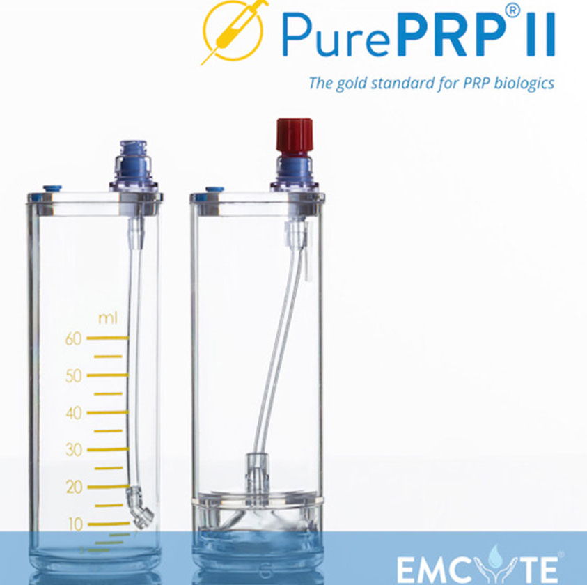 EmCyte Pure PRP concentrating tubes, used for the preparation of platelet-rich plasma (PRP). The tubes are clear and cylindrical with blood volume gradient markers and luer lock access ports for expressing and aspirating blood and it's components.
